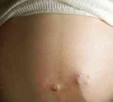 34 Tjedana trudnoće
