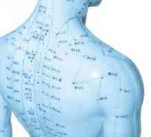 Akupunktura - aktivna pomoć pri osteochondrosis