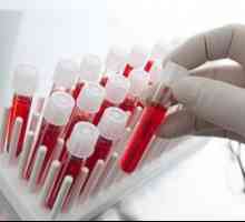 Alt analiza krvi: to je norma i odstupanje od norme