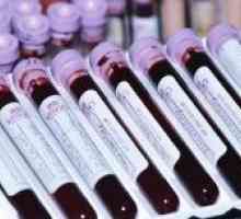 Amilaza u krvi: norma i odstupanje od norme