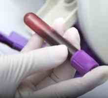 Test krvi za anti nvcor: postavljanje i dekodiranje