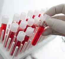 Analiza krvi za sprečavanje bolesti i crva