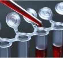 Test krvi za hormone štitnjače i proteina: priprema za istraživanje, tumačenje rezultata