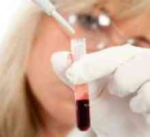 Test krvi na EMF