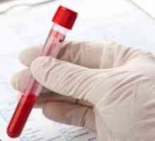 Test krvi za opisthorchiasis - priprema, postupak, dekodiranje i liječenje parazitarnih bolesti