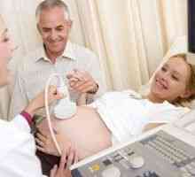 Dopler ultrazvuk u trudnoći - što je to, postupak pripreme i ispitivanja