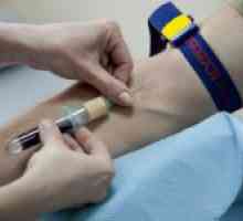 Što je krvni test rw i njegova interpretacija
