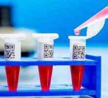 Krvni testovi na stanice raka, a njegova interpretacija