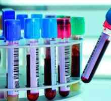 Testovi za spolno prenosivih bolesti za muškarce: vrste, svrhe i mogućih ishoda