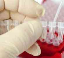 Koliko leukociti u krvi se smatra normalnim, a što ovisi o