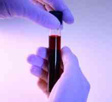 Test krvi za reumatoidni faktor je funkcija vrijednosti dekodiranje i analiza