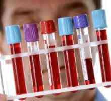 Krvni test za rak mokraćnog mjehura i njegove interpretacije