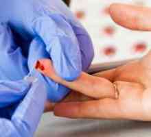 Test krvi - NST: normalno hematokrit, a razlog za odbijanje
