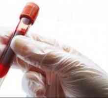 Test krvi za ESR Westergren: što je to? Ako su pravila povišen, što to znači i koje su posljedice?