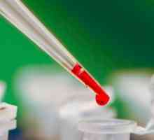 Test krvi je sklupčana: što to može značiti?
