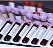 Analiza za TTG i priprema za doniranje krvi