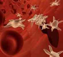 Analize su pokazale da su smanjeni trombociti u krvi, što znači i kako podići razinu crvenih krvnih…
