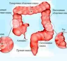 Anatomski struktura, bolesti i obrada sigmoidalne kolona
