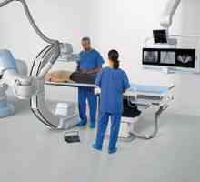 Angiografija: indikacije, proces izmjere i karakteristike postupka