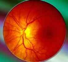 Mrežnice angiopatija oči u djece