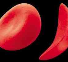 Anisocytosis crvenih krvnih stanica u krvi test (indeks rdw)