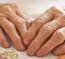 Artritis prstiju: tradicionalne terapije