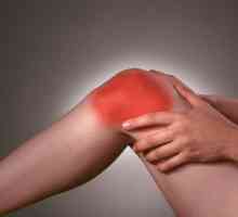 Osteoartritisom zgloba koljena 1 stupanj