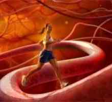 Ateroskleroza arterija donjih ekstremiteta i njeno liječenje
