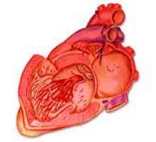 Simptomi koronarne bolesti srca