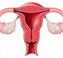 Atrezija grlića maternice u žena u postmenopauzi
