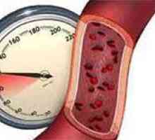 Labilnih hipertenzija (povišeni krvni tlak)