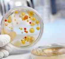 Bakteriološke metode u Microbiology: važnost metode i događaje