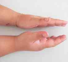 Nerazumno otečene i bolne ruka, podrijetlo i uklanjanje simptoma