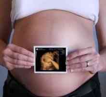 Je li sigurno ultrazvuk tijekom trudnoće?