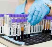 Biokemijski testovi krvi: dekodiranje stol za glavne vrijednosti