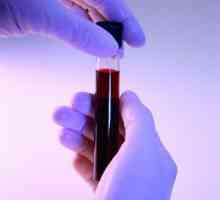 Biokemijska analiza krvi: priprema, držanja, dekodiranje i brzina