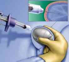 Biopsija testisa kod muškaraca: dokaze i postupak.