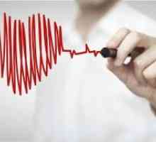 Bolesti srca - paroksizmalne sinus tahikardija: simptomi i tretman