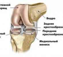 Bol u zglobu koljena