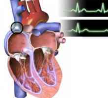 Bradikardija (nizak broj otkucaja srca) u djece i odraslih: vrste, podrijetla, simptomi, dijagnoza,…