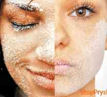 Neravan kože lica: eliminirati nedostatak