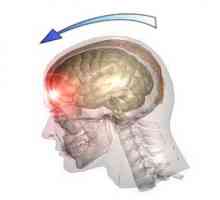 Traumatska ozljeda mozga (TBI), ozljede glave: uzroci, vrste, simptomi, liječenje