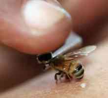 Što učiniti i što ukloniti otekline od ugriza osa, pčela i komaraca