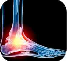 Što učiniti s osteoartritisom stopala?