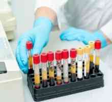 Što bi trebao sadržavati normalan zdrav ljudski analizu krvi