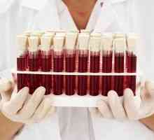Uzroci povećanje proteina u krvi i mogućim bolestima