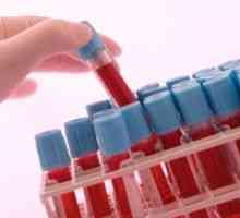 Što je to - test krvi Petit: vrijednost, norma i rizik odstupanja od norme