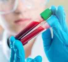 Što je to - GGT: imenovanje za test krvi, stopa enzima i moguće bolesti