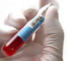 ALP norma u biokemijske analize krvi i uzrokuje enzima abnormalnosti