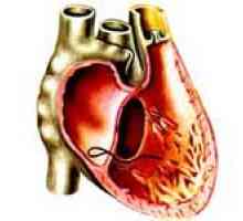 Uzroci i liječenje lijeve klijetke zatajenja srca